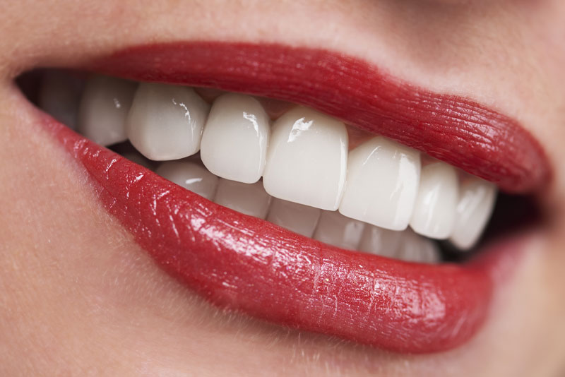 dental patient smiling after procedure